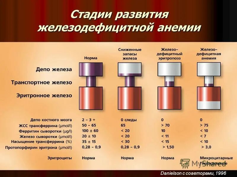 Железо в 3 года. Стадии развития жда. Стадии развития железодефицитной анемии. Стадии при железодефицитной анемии. Степени железодефицитной анемии по железу.