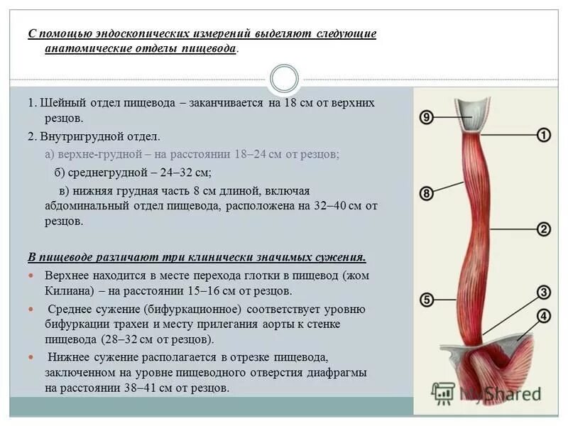 Сужение на латыни. Отделы пищевода. Отделы пищевода анатомия. Отделы и сужения пищевода. Верхний отдел пищевода.