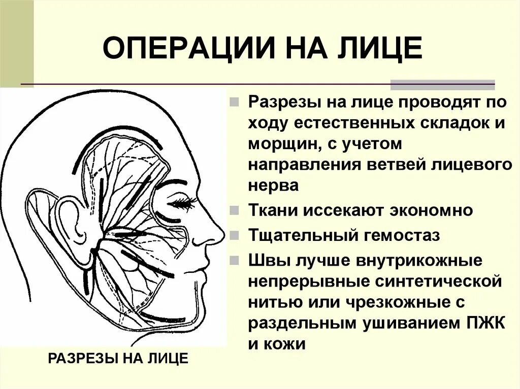 Операция нерва на лице. Разрезы на лице топографическая анатомия. лицевой нерв разрезы на лице топографическая анатомия. направление разрезов на лице. направление хирургических разрезов на лице.