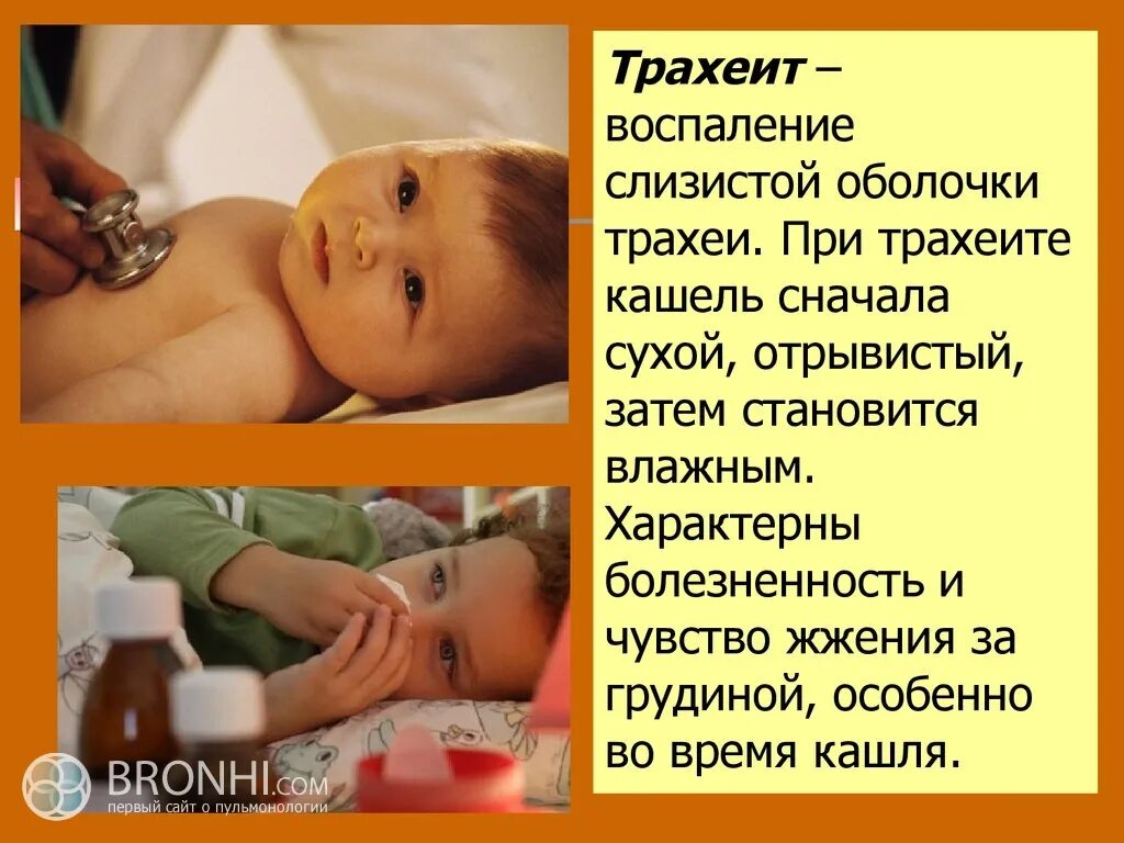 Отек при трахеите