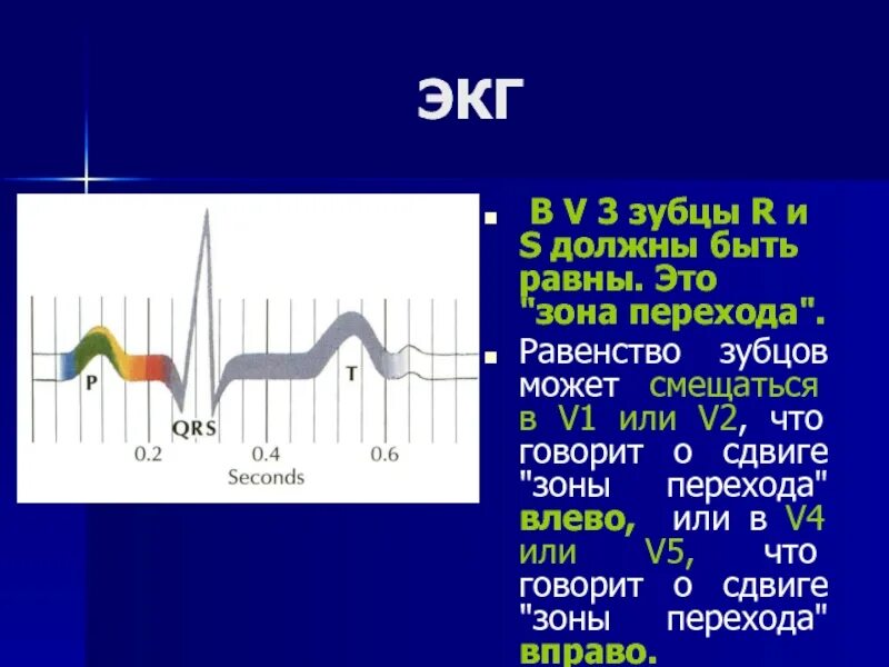 Нарастание зубца r. Переходная зона на ЭКГ. ЭКГ сердца переходная зона:v2-v3. Переходная зона в v2 на ЭКГ. В нормальной ЭКГ зубец р в v1.