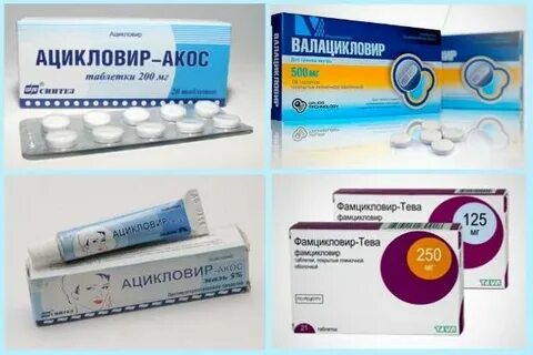 Боли при герпесе чем снять