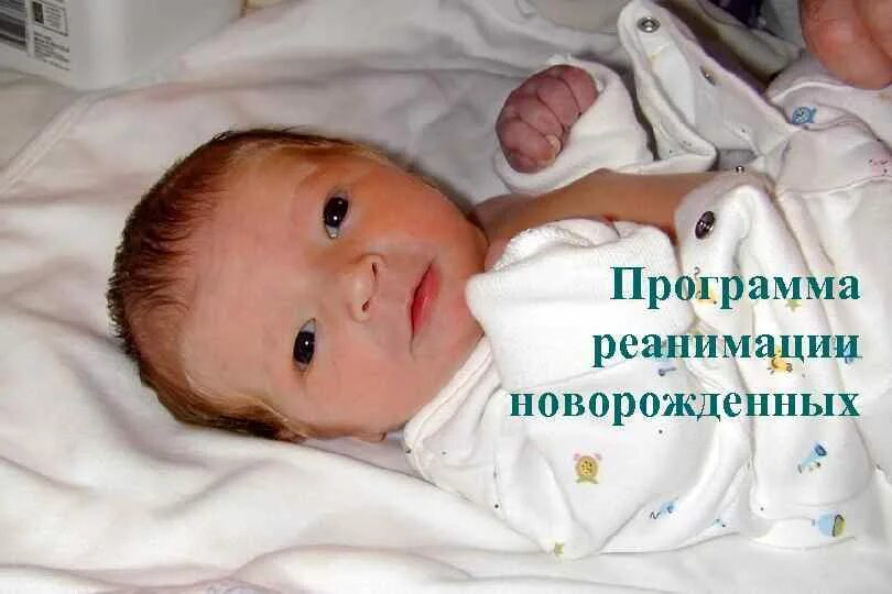 Ребенок в палате интенсивной терапии. Маленький ребёнок в реанимации. Ивл недоношенных новорожденных. Состояние новорожденных в реанимации. Состояние новорожденных в реанимации.