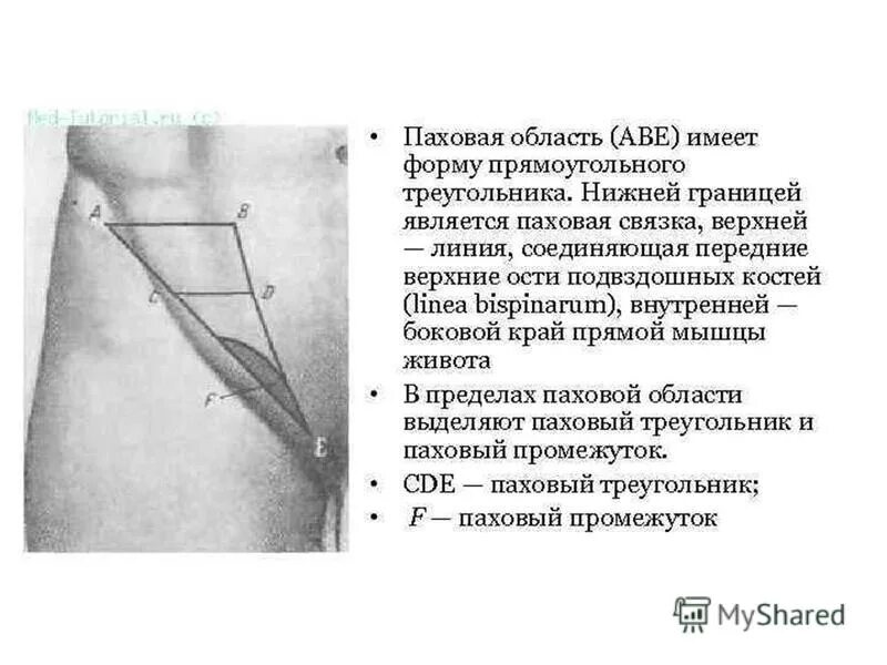 Почему боли в паху у мужчин. Паховая связка топографическая анатомия. Паховый промежуток топографическая анатомия. Подвздошно паховая область границы. Паховая складка анатомия.