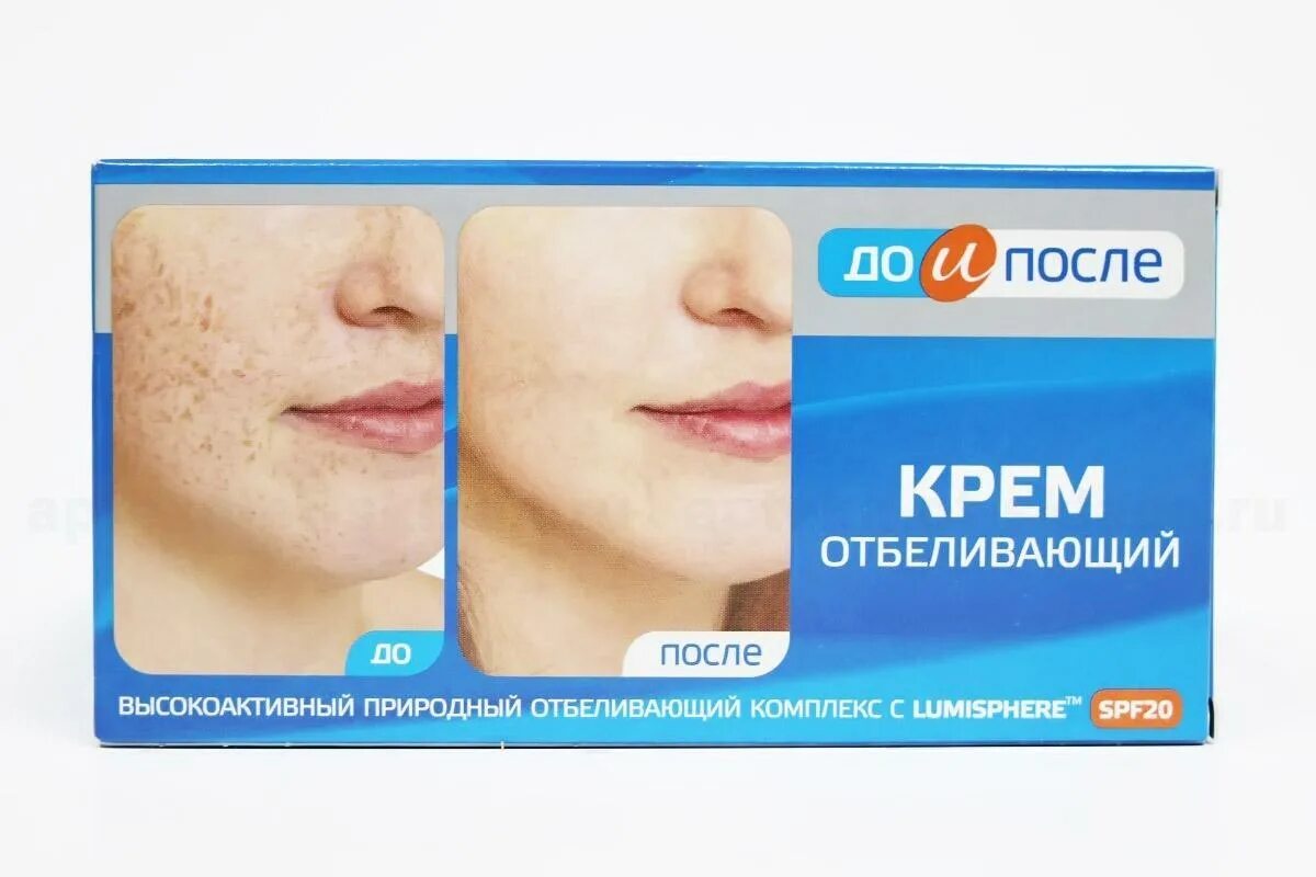 отбеливающий крем до и после. до и после крем отбеливающий твинс тэк. отбеливающий крем для лица твинс тэк. отбеленная кожа до и после. отбеливающий крем для лица до и после.