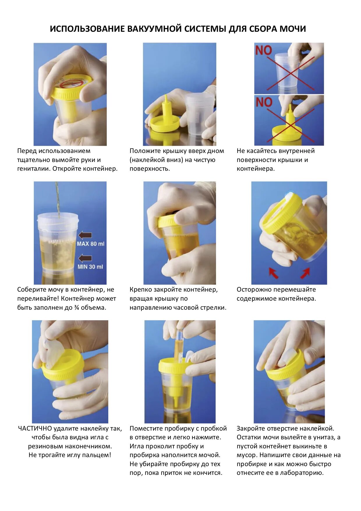 Как пользоваться вакуумной банкой для сбора мочи. Контейнер для сбора мочи на бак посев инструкция. Сбор мочи в контейнер с пробиркой инструкция. Баночка для сбора мочи для вакуума.