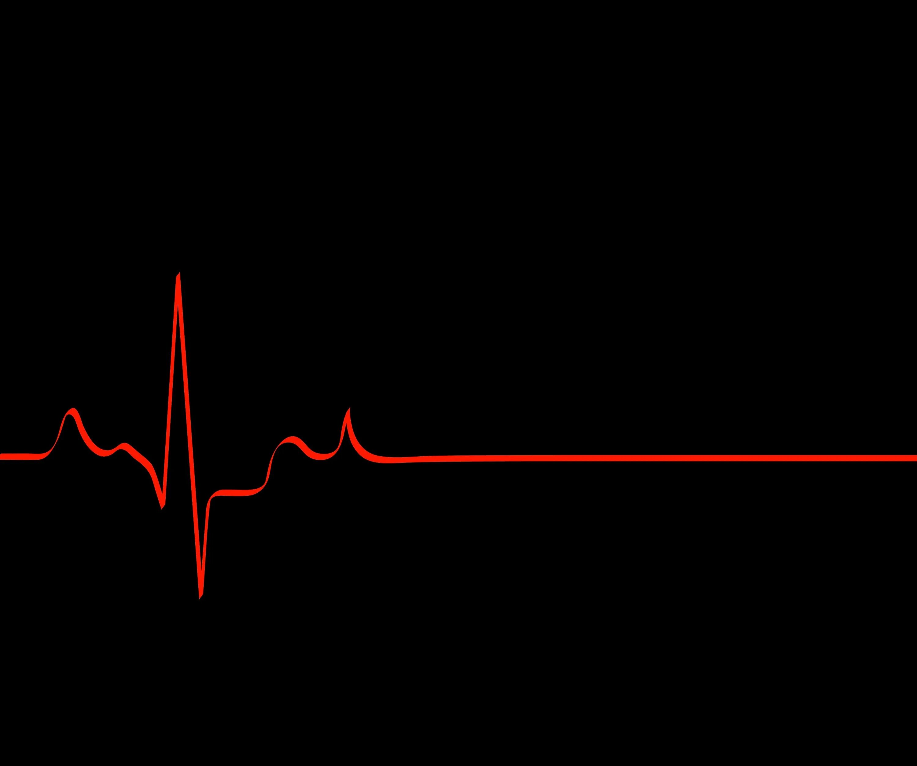 Кардиограмма остановки сердца. Пульс. Обои пульс. Кардиограмма серлце. Сердцебиение остановилось