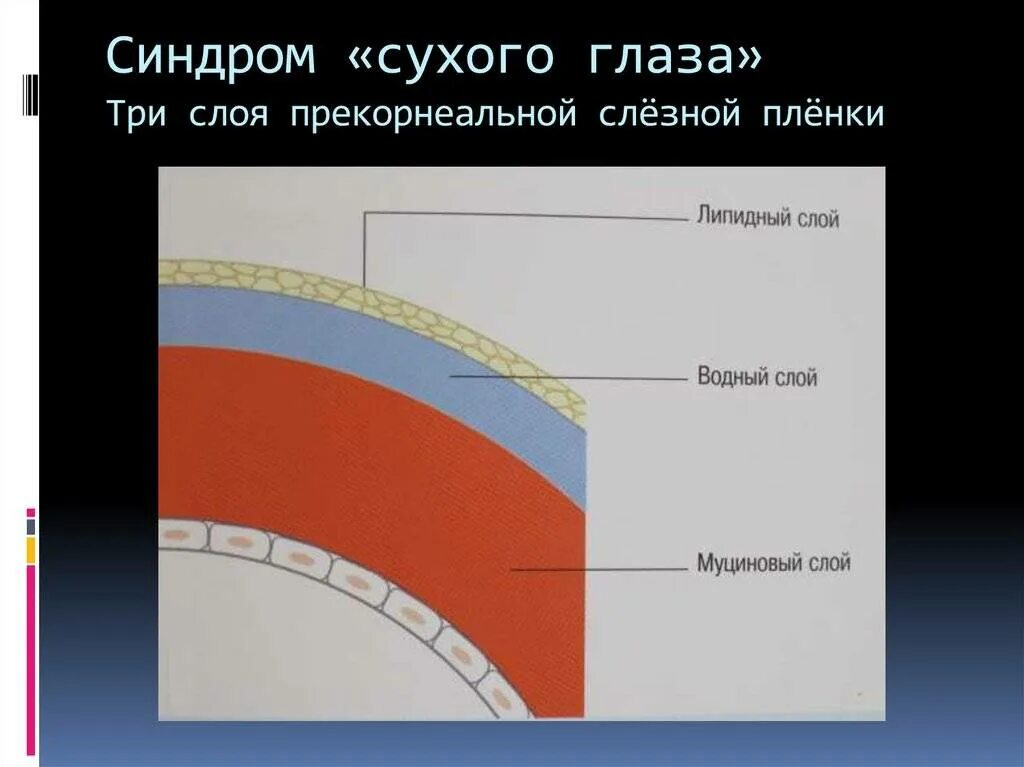 Причины симптома сухого глаза. Синдром сухого глаза презентация. Структура слезной пленки. Три слоя слезной пленки.