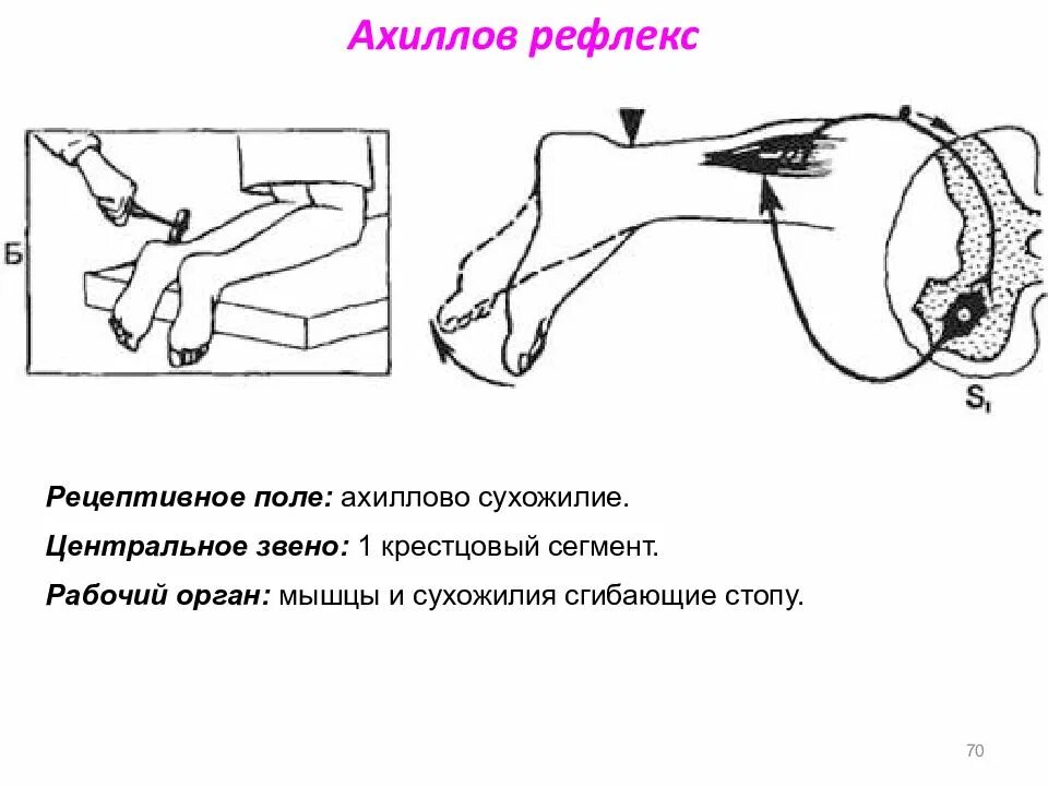 Поле рефлекса. Схема рефлекторной дуги ахиллова рефлекса. Ахиллов рефлекс 5 звеньев. Ахиллов рефлекс схема рефлекторной дуги. Ахиллов рефлекс моносинаптический.