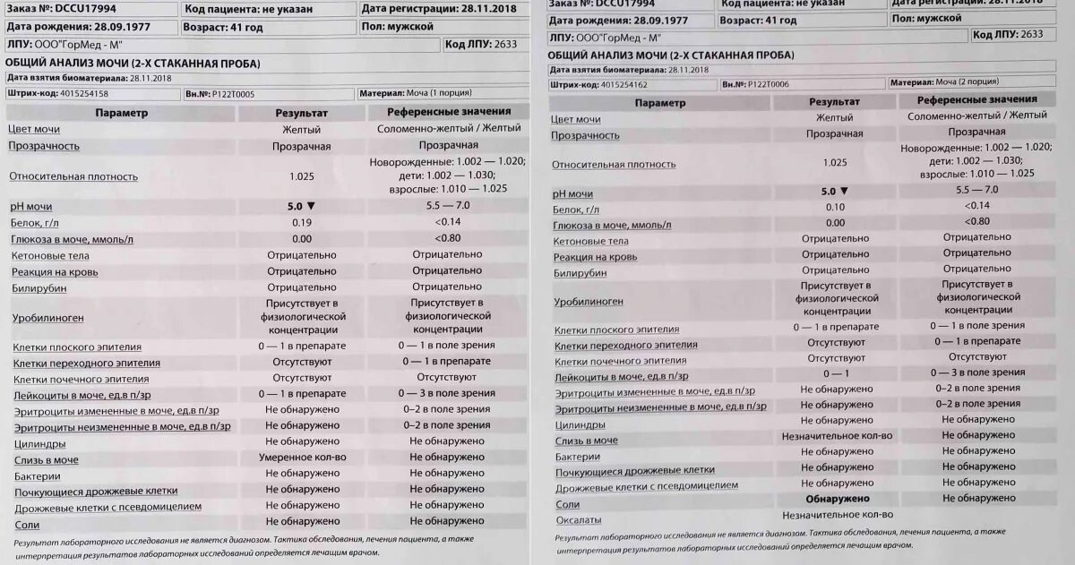 Почему повышенный эритроциты в моче. Белок и лейкоциты в моче. Белок лейкоциты и эритроциты в моче. Повышен белок и эритроциты в моче. Общий анализ мочи цилиндры.