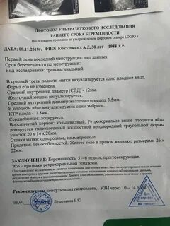 Узи прост