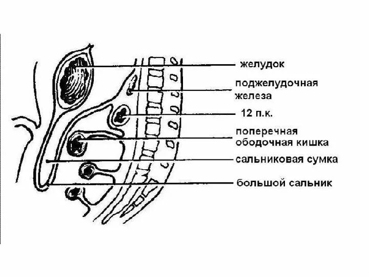 Винслово отверстие. Сальниковая сумка брюшины. Стенки сальниковой сумки брюшины. Сальниковая сумка границы сообщения. Верхнее углубление сальниковой сумки.