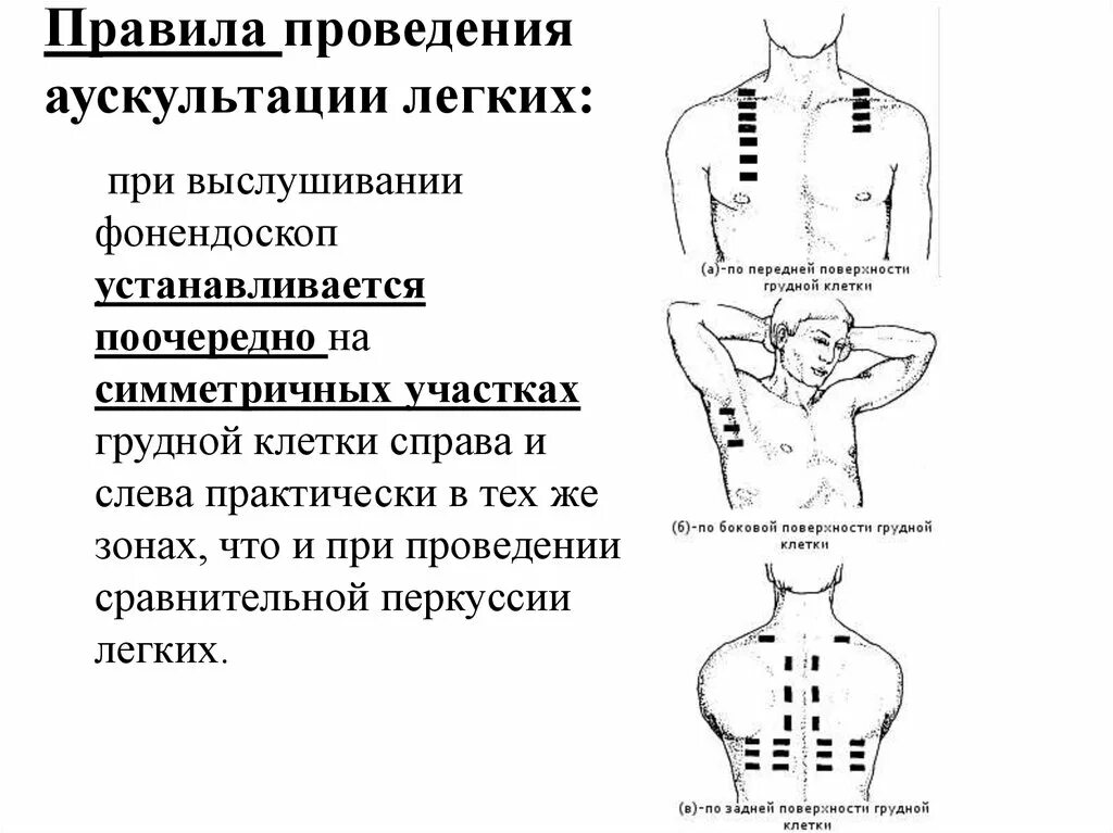 Схема проведения аускультации легких. Точки сравнительной аускультации легких. Аускультация легких пропедевтика внутренних болезней. Методика проведения аускультации легких.