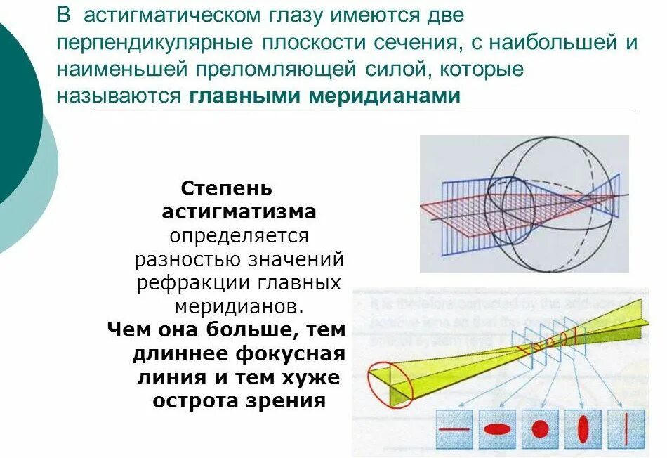 Главные меридианы астигматического глаза это. Разница рефракции астигматизм. Методы коррекции астигматизма. Астигматизм нарушение рефракции глаза при котором.