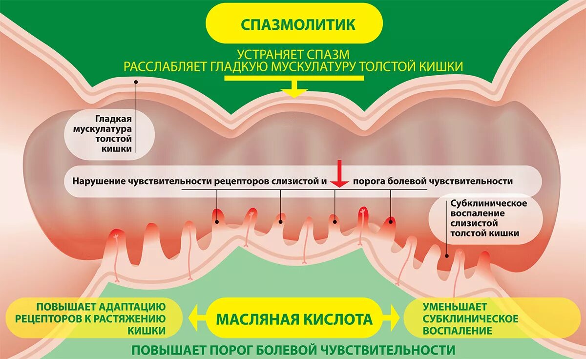 Фотографии СПАЗМ КИШЕЧНИКА У РЕБЕНКА