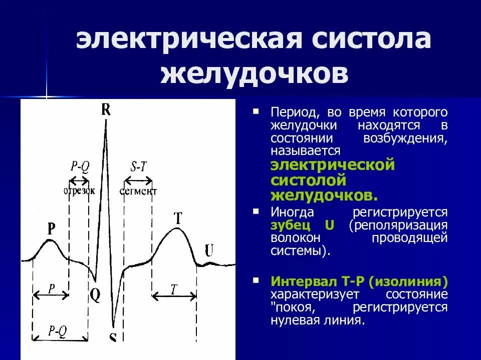 Электрическая систола сердца на ЭКГ это. Электрическую систолу желудочков на ЭКГ отражает. Систола желудочков на ЭКГ. Электрической систолой желудочков является.