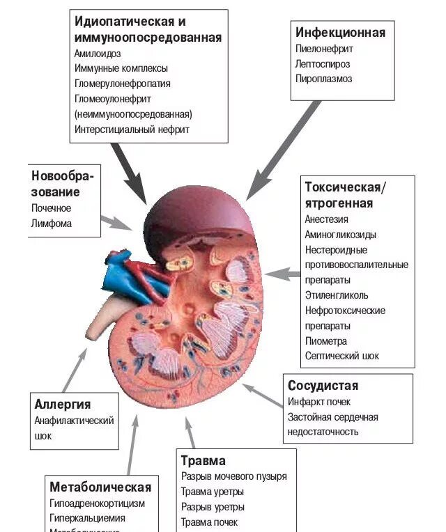 Заболевания связанные с почками. Клинические симптомы ХПН. Острая и хроническая почечная недостаточность симптомы. Факторы хронической почечной недостаточности. Причины заболевания острая почечная недостаточность.