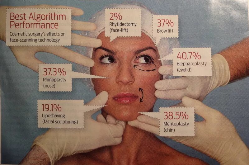 Surgery перевод. Sculpturing face книга. Not successful Cosmetic Surgery. Facial Memories scan-Tech.