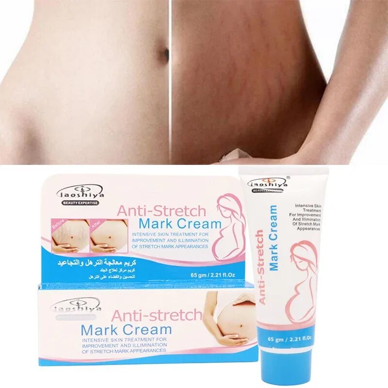 Stretch mark cream. Anti stretch Mark Cream для беременных. Stretch Marks Cream от растяжек. Крем от растяжек стрейч Маркс.