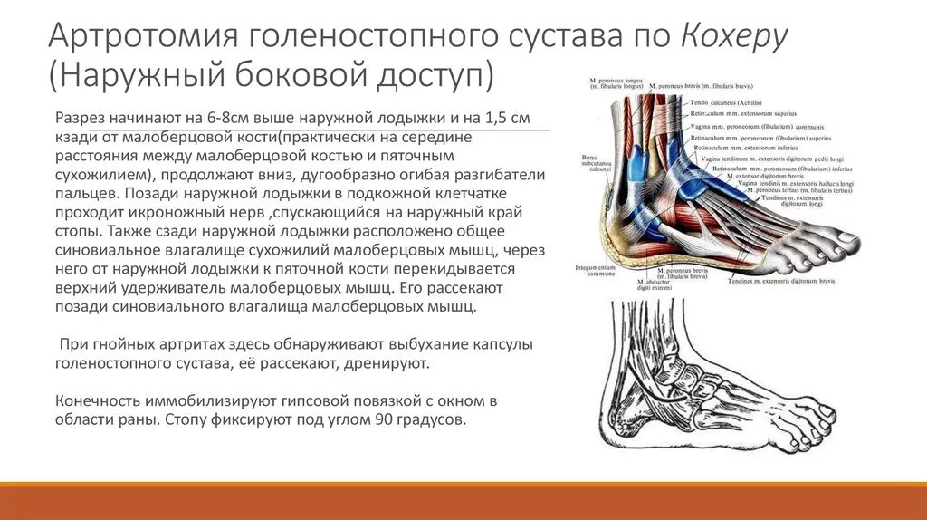 Почему болит голеностопный сустав. Сухожилия голеностопного сустава анатомия. Латеральный связочный комплекс голеностопного сустава. Строение сухожилий голеностопного сустава. Голеностопный сустав анатомия строение мышцы.