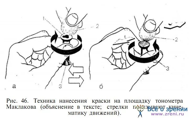 Внутриглазное давление по маклакову. Аппарат Маклакова для измерения внутриглазного давления. Измерение внутриглазного давления тонометром Маклакова. Тонометр внутриглазного давления по маклакову. Алгоритм измерения внутриглазного давления тонометром.