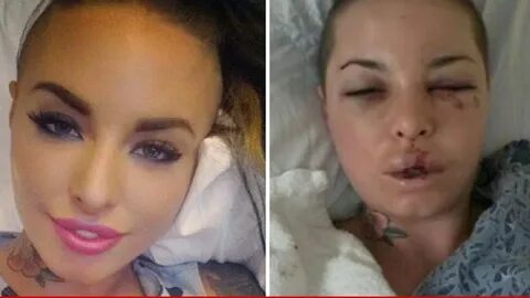 Christy Mack -- Porn Stars Raise $$$ For Face Reconstruction.