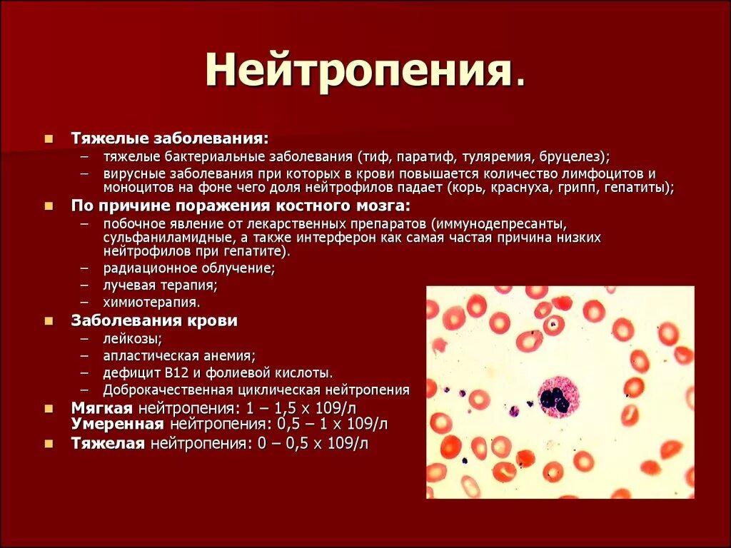 Лейкоцитоз тромбоцитопения. Сегментоядерные нейтропения. Нейтропения характерна для. Нейтропения картина крови. Снижение сегментоядерных нейтрофилов в крови.