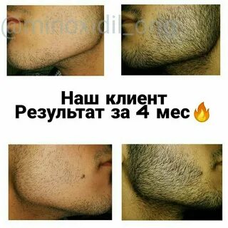 Борода мужская депиляция