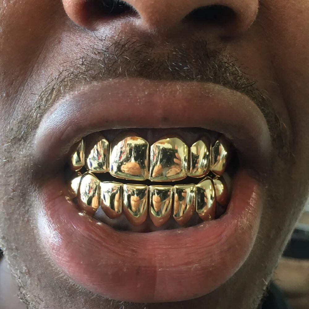 Сколько стоит металлические зубы. Rapper Grillz.