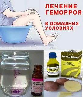 Обострение геморроя у женщины