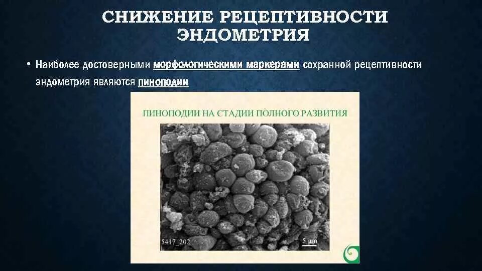 Снижение рецептивности эндометрия. Пиноподии эндометрия. Методы оценки эндометрия. Определение рецептивности эндометрия. Тонкое эндометрия отзывы