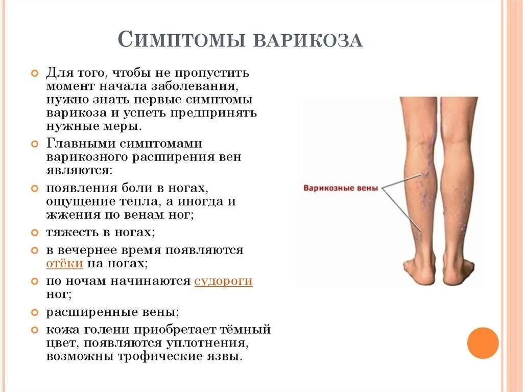 Симптомы варикозного расширения. Варикозное расширение вен симптомы. Варикозное расширение вен нижних конечностей симп. Признаками отеков являются тест