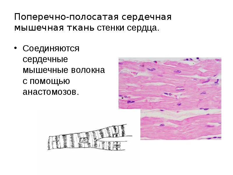 Волокна поперечно полосатой мышечной ткани ядра. Волокна поперечно-полосатой сердечной мышечной ткани. Строение поперечно полосатой сердечной мышечной ткани. Сердечная поперечно-полосатая мышечная функции. Поперечно-полосатая сердечная мышечная ткань препарат.