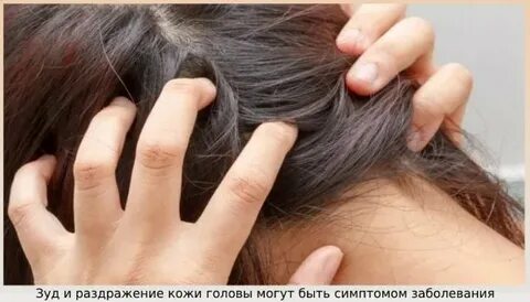 Чешется голова выпадают волосы причина лечение
