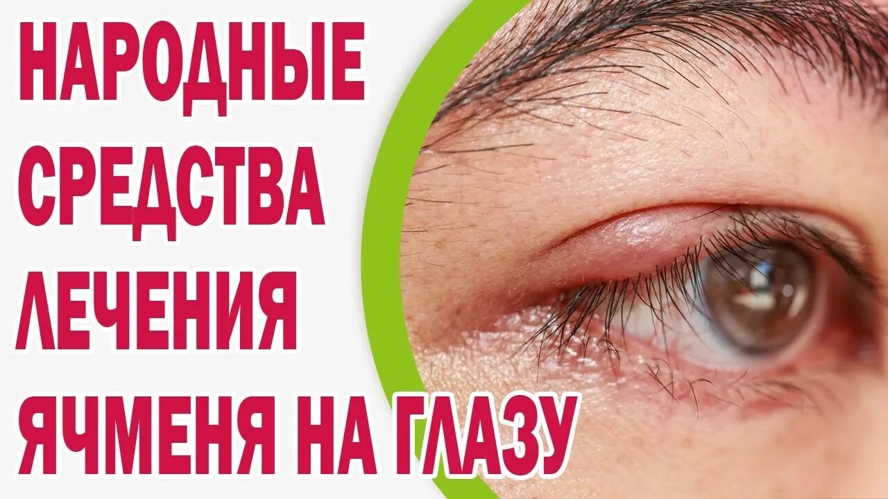Ячмень на глазу способы. Лекарство от избавления ячменя на глазу. народные средства от ячменя.