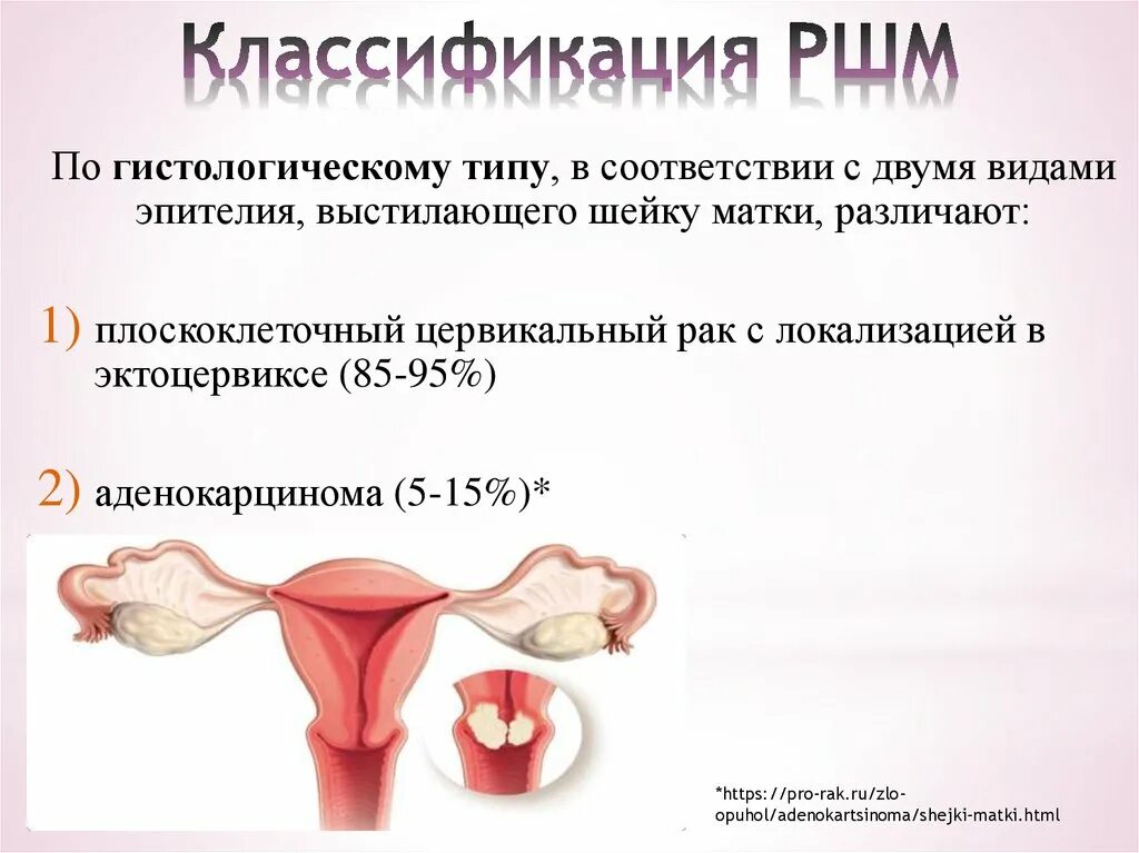 Клиника рака матки. Симптомы ракмшейки матки. Злокачественное новообразование шейки матки.
