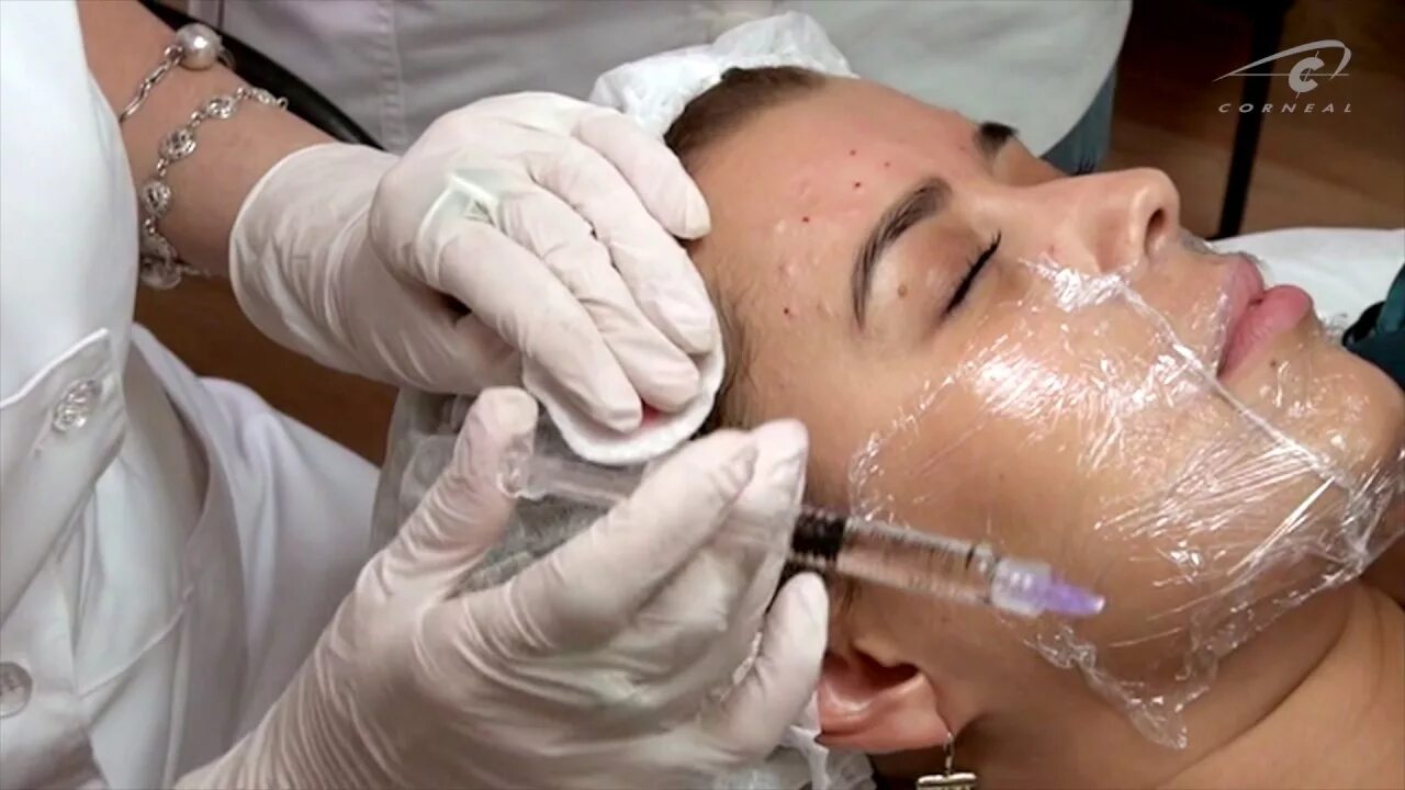 Массаж после биоревитализации. Мезотерапия для мужчин лицо. Техника биоревитализации.