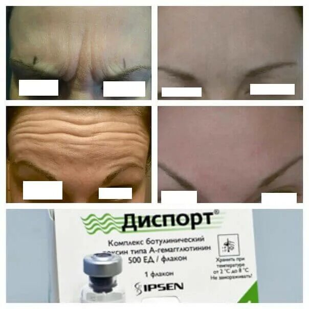 диспорт балашиха