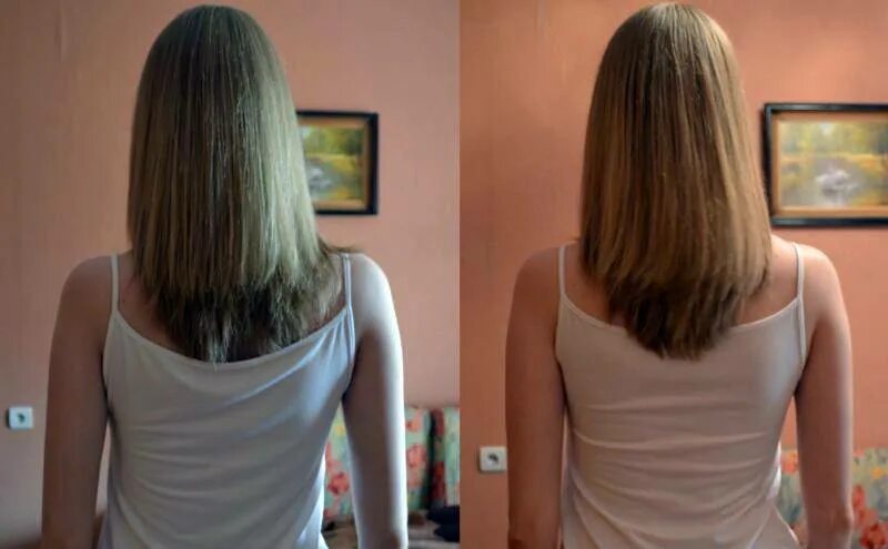 Волосы до после. Никотинка для волос до и после. Рост волос до и после. Никотиновая кислота для волос.