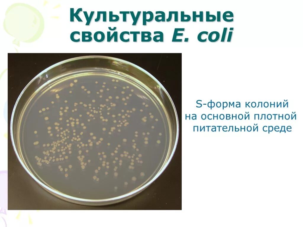 Культуральные свойства. Культуральные микроорганизмов. Культурал ные свойства бакьериц. Культуральные свойства бактерий. Культуральные микроорганизмов.