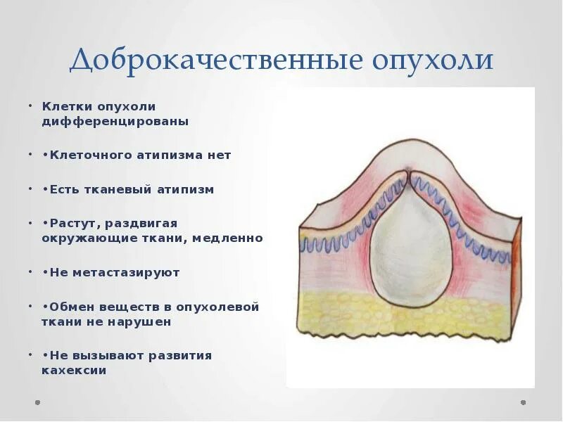 Доброкачественная опухоль. Доброкачественныеопкхоли. Доброкачественные новообразования. Доброкачественные и злокачественные опухоли. Опухоль подвижна