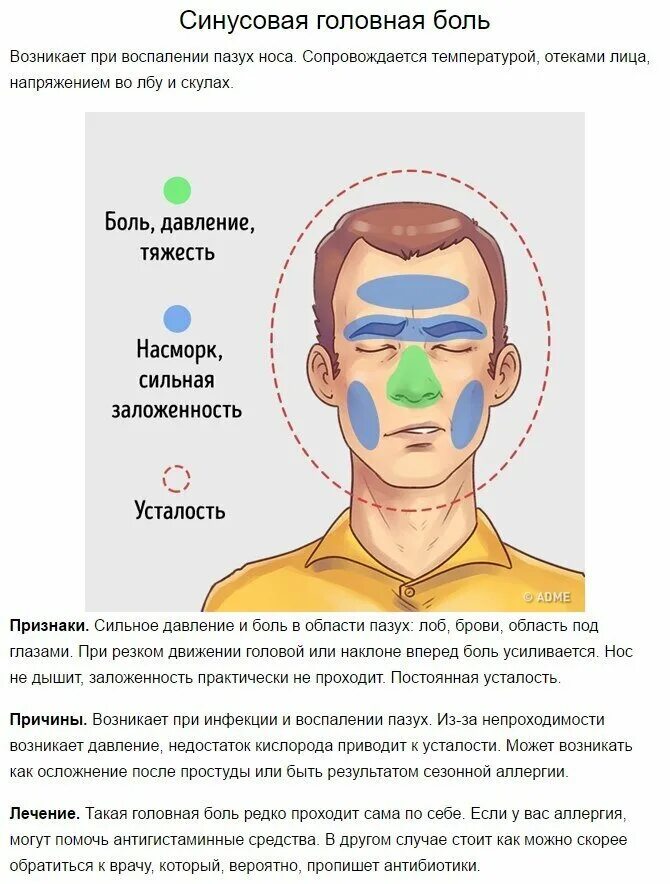 Боли костей лица. Типы головной боли. Болит голова. Типы головной боли и причины.