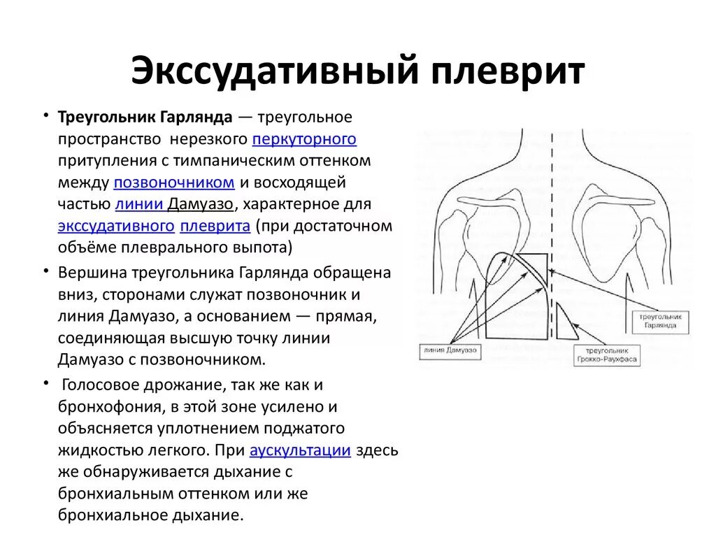 Ритм дыхания при экссудативном плеврите. Исследование экссудата при плеврите. Что такое экссудативный плеврит лёгких. Экссудативный плеврит симптомы.