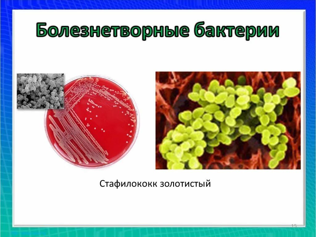 Болезнетворные бактерии роль в природе. Роль стафилококков в природе. Общая характеристика бактерий презентация. Роль болезнетворных бактерий в природе и жизни человека.