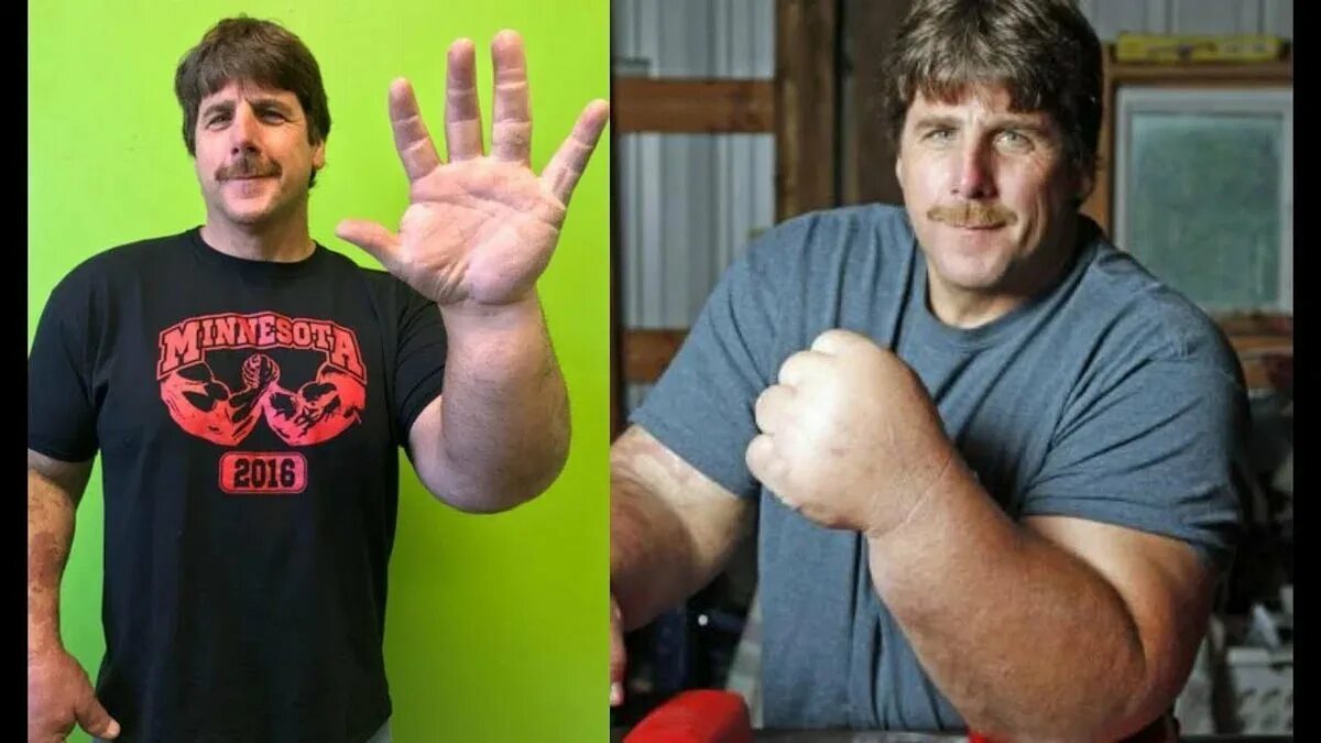 Матеуш шлитте. Маттиас шлитте. Армрестлер с большой рукой. Армрестлер с большой рукой. Чемпион мира по армрестлингу маттиас шлитте.