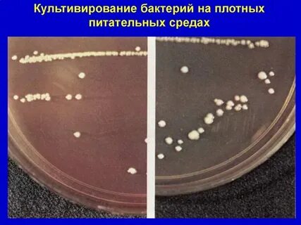 Выращивание ткани на питательной среде метод биологии