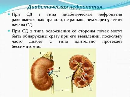 Симптомы нефропатии при сахарном диабете 2 типа