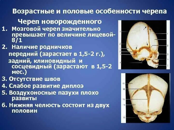 Кости и швы черепа анатомия. Возрастные особенности строения черепа анатомия. Возрастные особенности костей черепа. Соединение костей черепа. Череп новорожденного.. Характеристика родничка