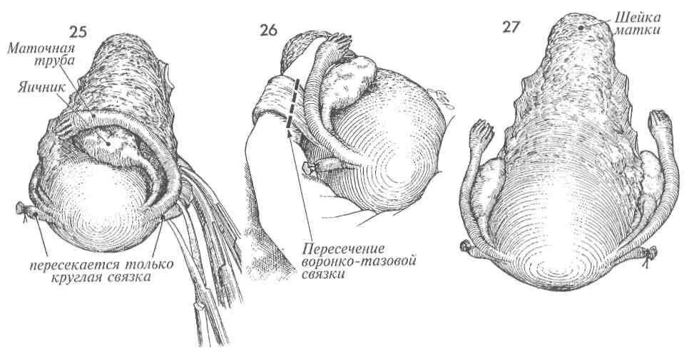 Маточных связки матки. Воронко тазовая связка матки. Связки матки - Воронко-тазовая связка. Воронко-тазовая связка яичника анатомия. Топография широкой связки матки.