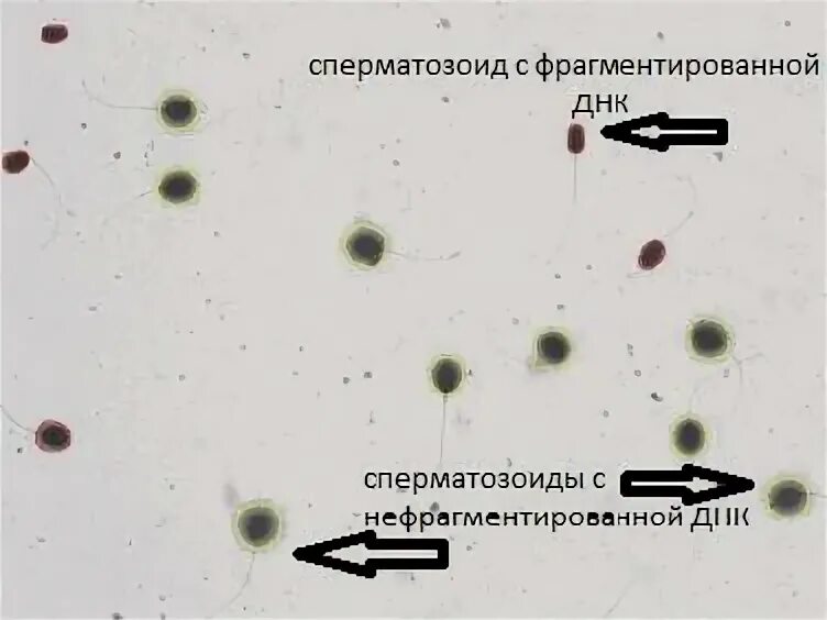 Днк спермограмма сдать. Фрагментация днк сперматозоидов анализ. фрагментация днк спермо. спермограмма днк. спермограмма с днк фрагментацией.